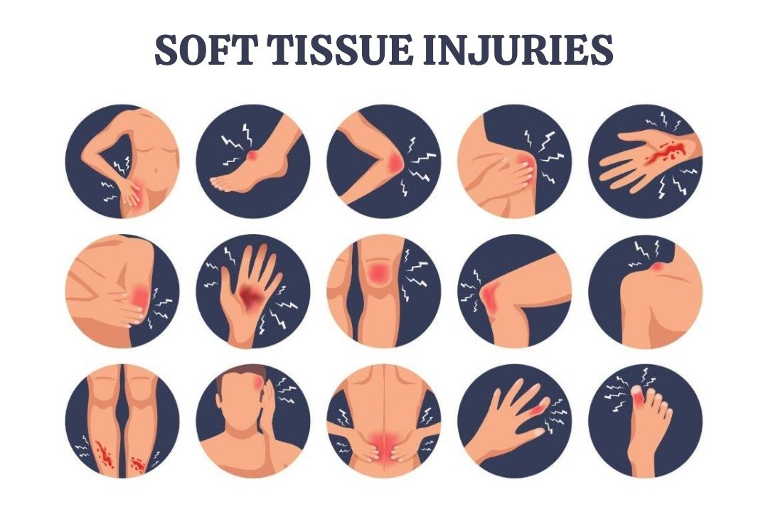 11-best-tips-for-soft-tissue-injuries-management